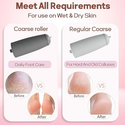 Aspiral Rechargeable Electric Callus Remover for Feet | Waterproof 2-Speed Pedicure Foot Grinder with LED Light