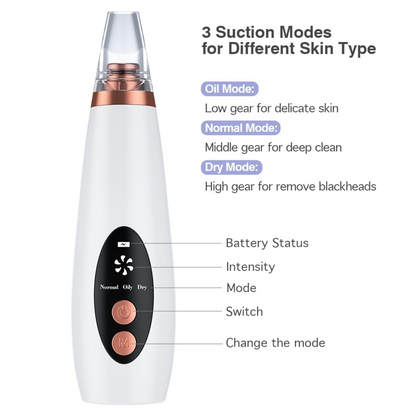 Aspiral Professional Electric Blackhead Remover Vacuum | Deep Pore Cleanser, Whitehead & Acne Suction Device with 3 Modes