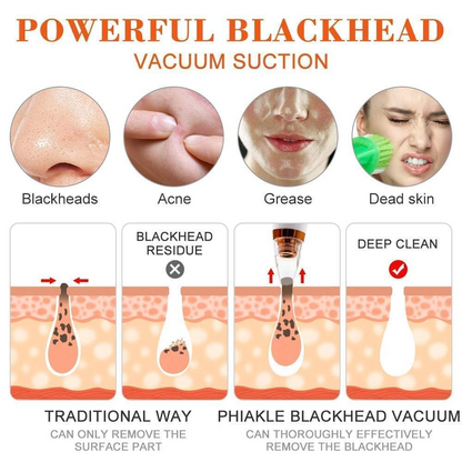 Aspiral Professional Electric Blackhead Remover Vacuum | Deep Pore Cleanser, Whitehead & Acne Suction Device with 3 Modes